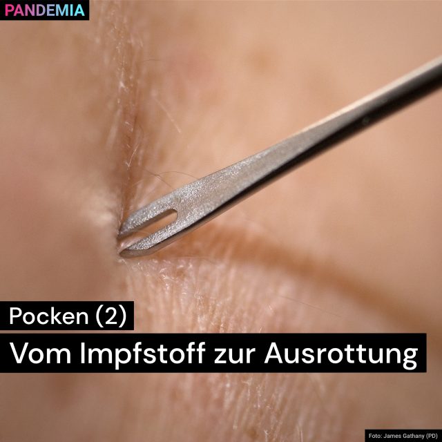 Pocken | Vom Impfstoff zur Ausrottung | Pandemia