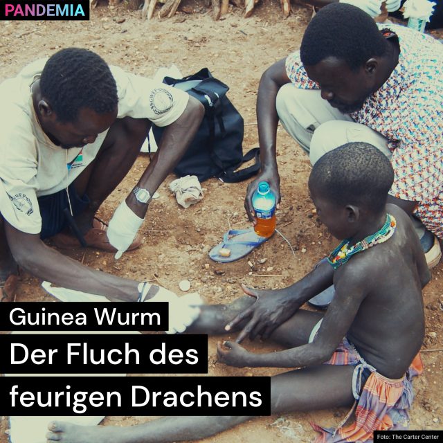 Guinea Wurm – Der Fluch des feurigen Drachens | Pandemia